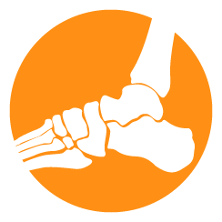 Foot & ankle injuries