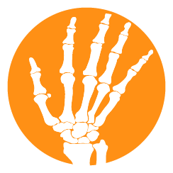 Wrist pain